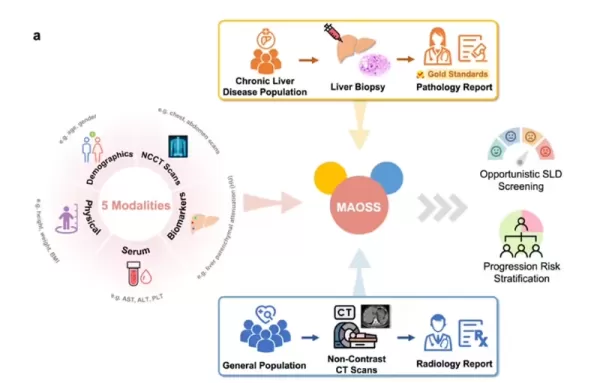 Tmall представляет модель искусственного интеллекта MAOSS для скрининга жировой дистрофии печени