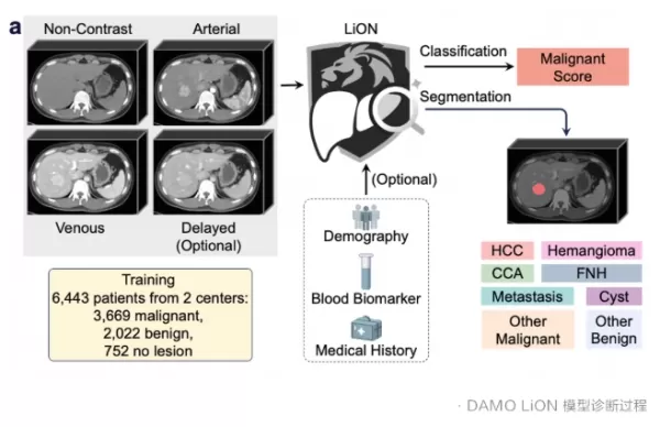 La Alibaba DAMO Academy desarrolló el modelo de IA para el diagnóstico del cáncer de hígado DAMO LiON en colaboración con el Hospital Shengjing y otras instituciones. Este modelo fue probado durante un ensayo en condiciones reales que duró dos meses y en el que participaron más de 10.000 pacientes; permitió detectar 15 tumores malignos que anteriormente no se habían identificado, la mayoría de ellos con un tamaño de aproximadamente 1 cm. Un artículo relacionado con este estudio fue publicado en Nature Medicine. DAMO LiON emplea una arquitectura de red mejorada que permite detectar con precisión lesiones hepáticas pequeñas ocultas por condiciones como la cirrosis o una anatomía compleja, logrando una exactitud superior a la de los radiólogos. Al utilizarse junto a médicos humanos, reduce el tiempo necesario para realizar los exámenes en un 27 % y aumenta la sensibilidad en un 11,5 %, lo que ayuda a los médicos menos experimentados a alcanzar un nivel de desempeño similar al de los especialistas. En la práctica, si el diagnóstico inicial realizado por la IA difiere de las evaluaciones iniciales realizadas por humanos, el caso es revisado por médicos de mayor experiencia, y se activan revisiones multidisciplinarias cuando es necesario. El modelo identificó correctamente una metástasis hepática en un paciente de 65 años con cáncer de vejiga, cuyos exámenes iniciales solo mostraban marcadores tumorales normales y calcificaciones, lo que permitió modificar su plan de quimioterapia. Desde 2017, la DAMO Academy ha ampliado sus capacidades en inteligencia artificial médica, pasando de las pruebas de detección al diagnóstico, con el objetivo de ayudar a más pacientes a recibir un tratamiento oportuno y preciso.